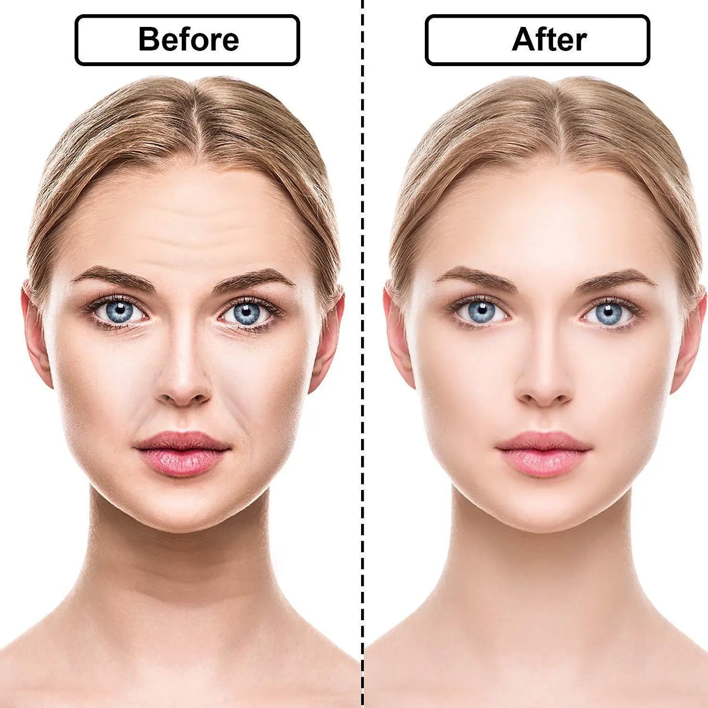 Anti-Aging Skin Lift Patches