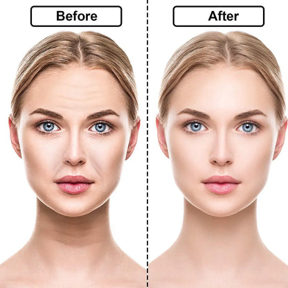 Anti-Aging Skin Lift Patches