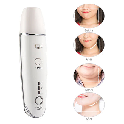Radiant Skin Tightening Device
