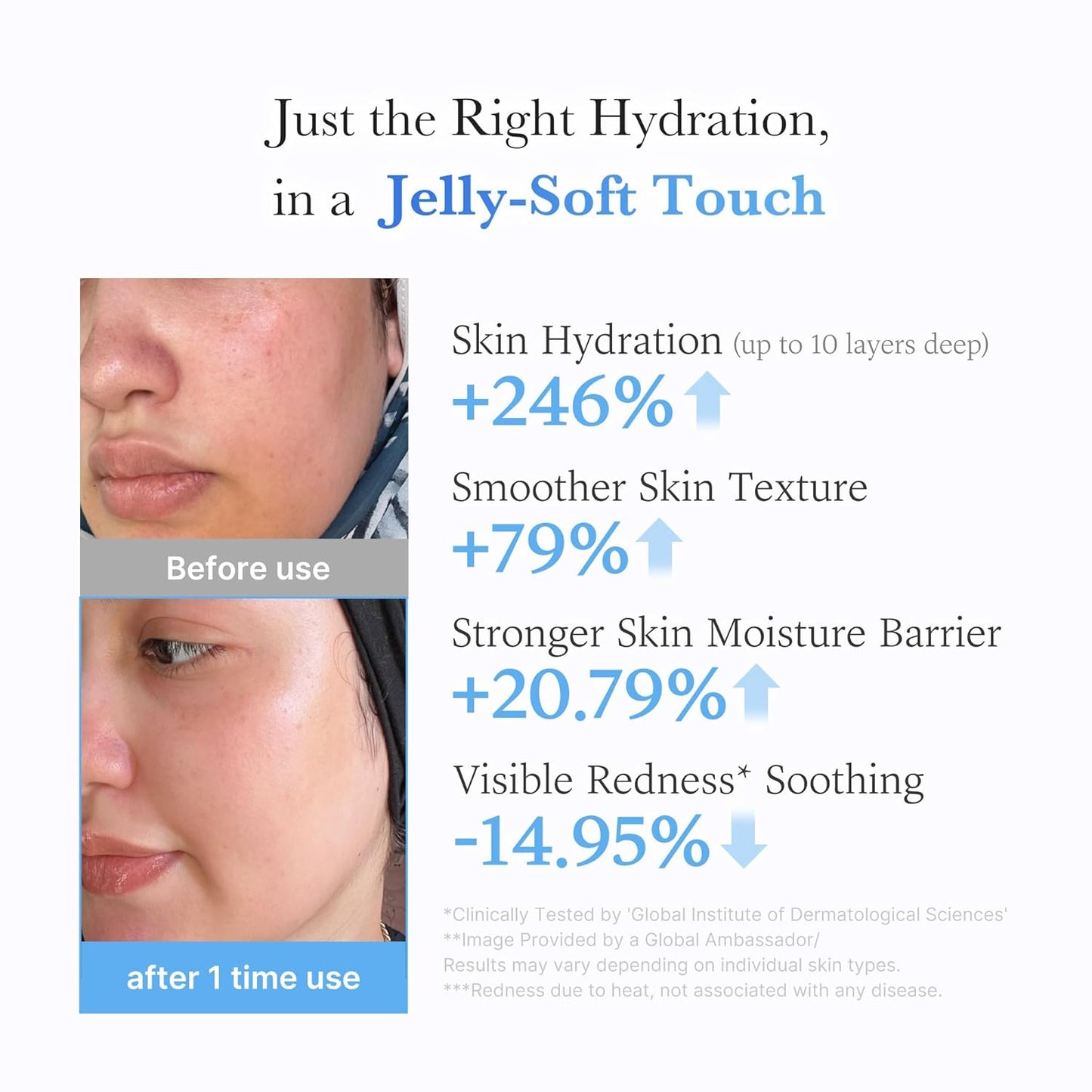 Hyaluronic Jelly Cream