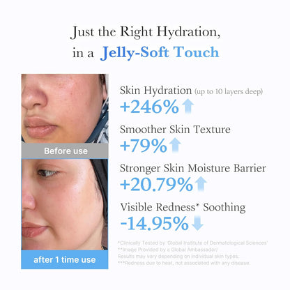 Hyaluronic Jelly Cream