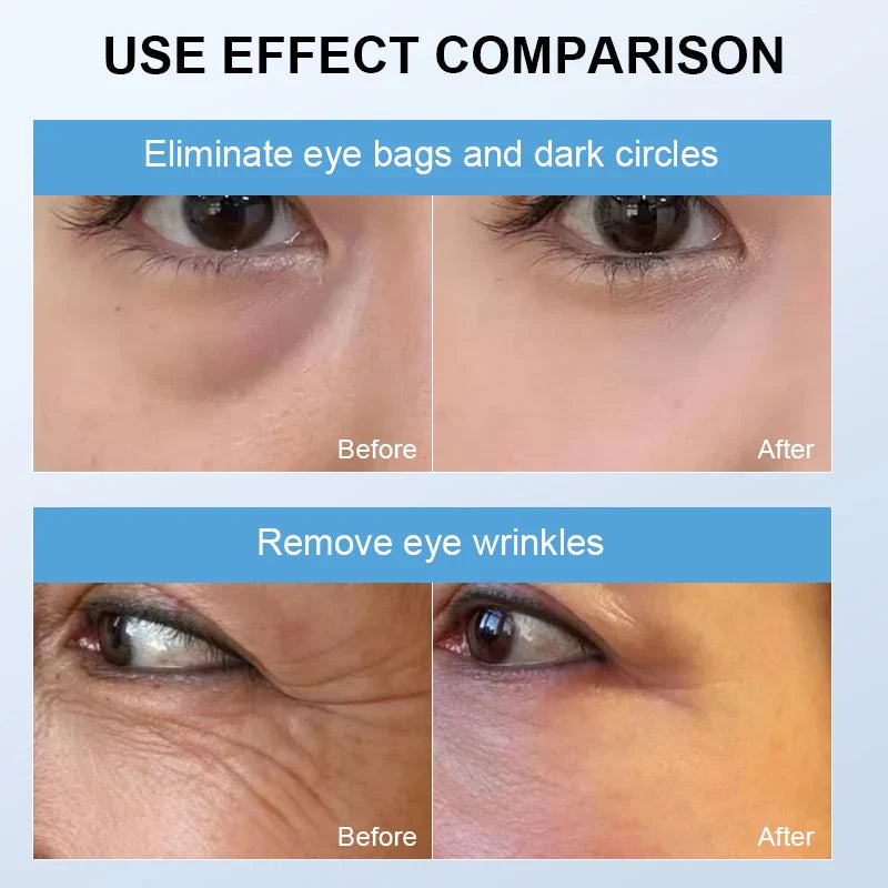 Revitalizing Eye Spa Device