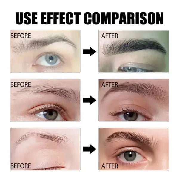 Eyebrow-Growth-Serum-Eyelash-Hair-Growth-Anti-Hairs-Loss-Product-Prevent-Baldness-Fuller-Thicker-Lengthening-Eyebrow.jpg