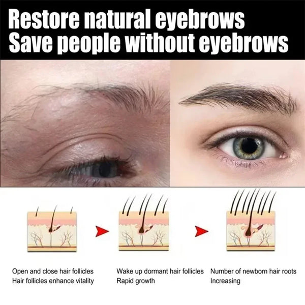 Eyebrow-Growth-Serum-Eyelash-Hair-Growth-Anti-Hairs-Loss-Product-Prevent-Baldness-Fuller-Thicker-Lengthening-Eyebrow.jpg