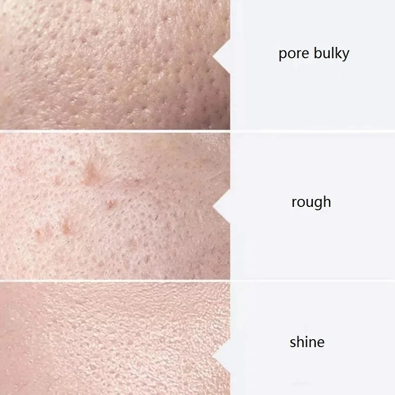 GlowBoost Aqua Peel Kit