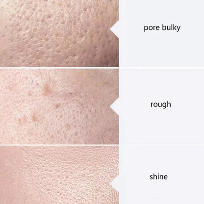 GlowBoost Aqua Peel Kit