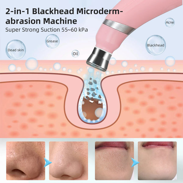 Foreverlily-Portable-Diamond-Peeling-Machine-Microdermabrasion-Facial-Cleaning-Device-Exfoliation-Vacuum-Blackhead-Remover.jpg