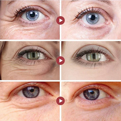 Bright Eyes Lifting Cream
