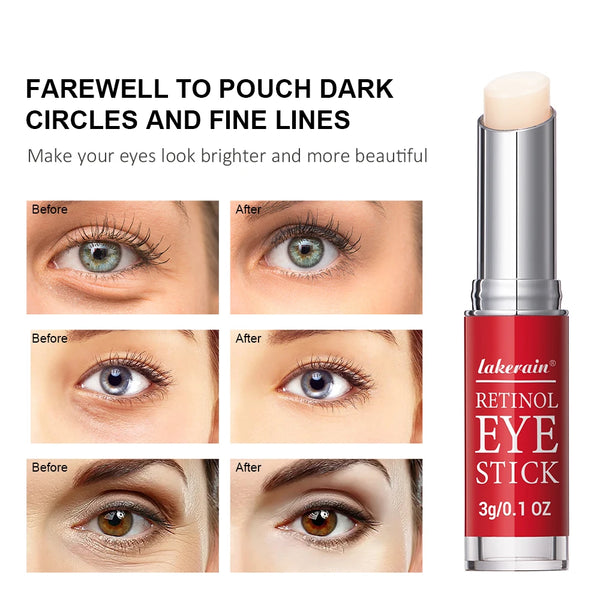 Retinol-Eye-Cream-Lightening-Dark-Circles-Firming-Skin-Instant-Eye-Repair-Serum-Stick-for-women-Women.jpg
